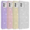 Galaxy A03 Kılıf Zore Shining Silikon