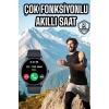 Akıllı Saat Çok Fonksiyonlu Sesli Görüşme NFC Uyumlu Amoled Ekran